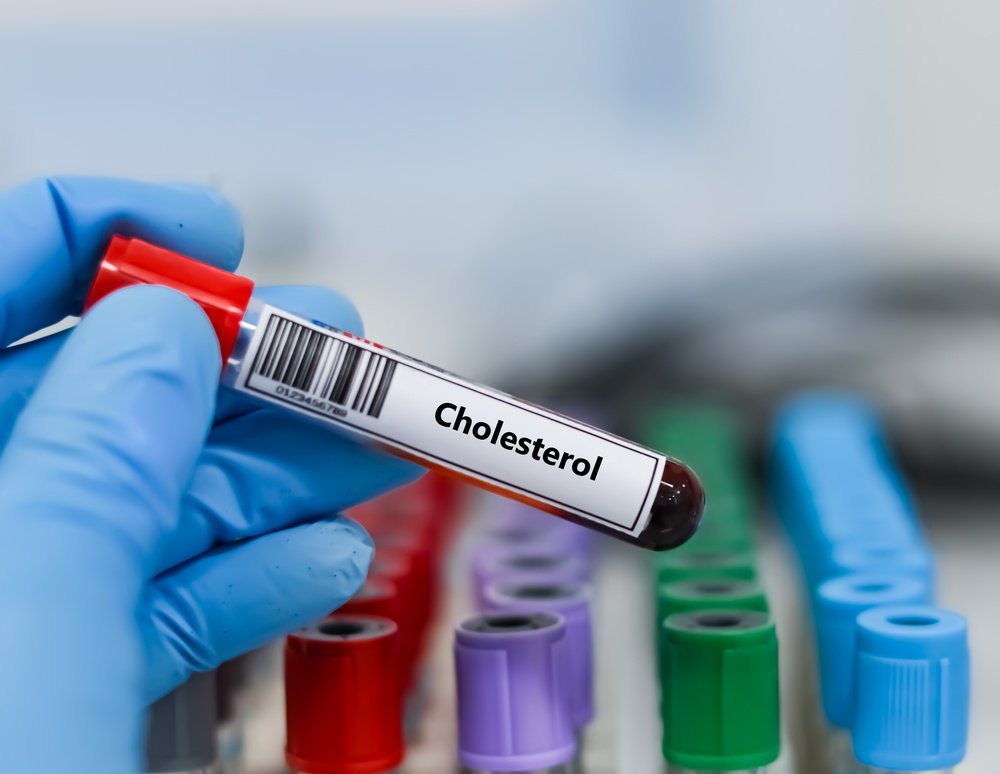 High Cholesterol and Heart Disease: What You Should Know